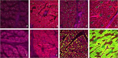 miRNA transcriptome and myofiber characteristics of lamb skeletal muscle during hypertrophic growth1